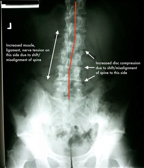 hentai x-ray|X Ray Hentai